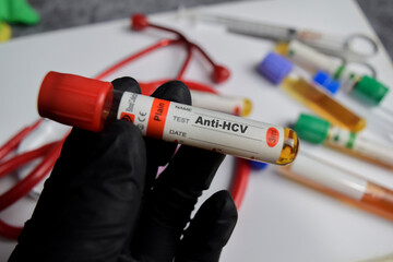 Anti-HCV vaccination drug in black gloved hands. Medical concept