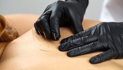 Close-up of acupuncture treatment