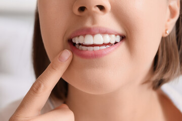 Young woman with occlusal splint in bedroom, closeup