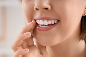 Young woman with occlusal splint in bathroom, closeup