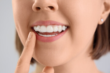 Young woman with occlusal splint on light background, closeup