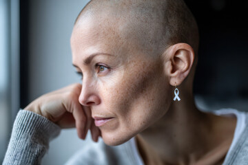 Obraz premium A young woman of Caucasian ethnicity is indoors at home. She appears to be thinking about her life. Her head is bald due to chemotheraphy