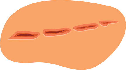 Realistic illustration of a deep skin cut showing muscle tissue, ideal for medical and healthcare publications