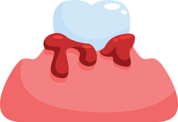 Gum inflammation causing bleeding is a sign of periodontitis and requires a dentist visit