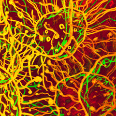 T Cell Cancer. Vivid Flu Germ. Burgundy Science