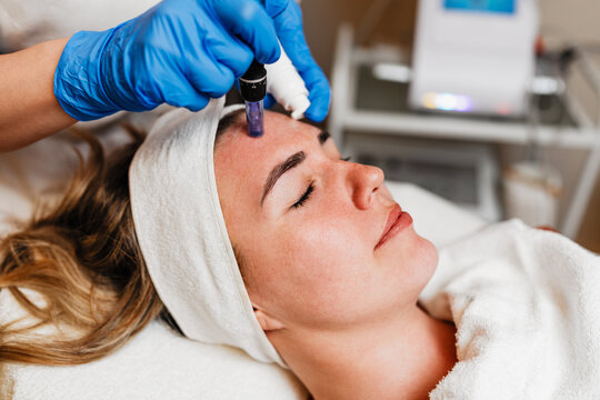 Beautician wearing blue gloves uses a microneedling pen to apply serum to forehead of client with closed eyes lying on a treatment table during a beauty spa procedure. Modern anti-age procedure.