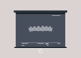 Highlighted on a display board is a detailed x ray showing clear aligners designed for straightening teeth, This presentation emphasizes the intricate process of orthodontic correction