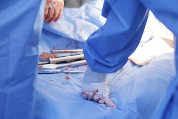 Tired surgeon hand pressing during difficult surgery with blood and instruments in theater