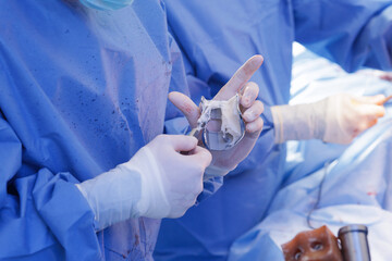 Bone cement application on knee implant during total knee arthroplasty