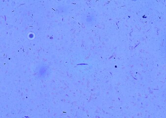 soil microorganisms under a microscope including amoeba, flagellates, nematodes, fungi, bacteria	