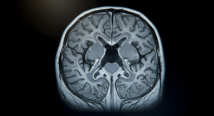 High-Resolution MRI Brain Scan Revealing Detailed Anatomy Of The Human Brain Structure And Its Complex Neural Pathways And Functions