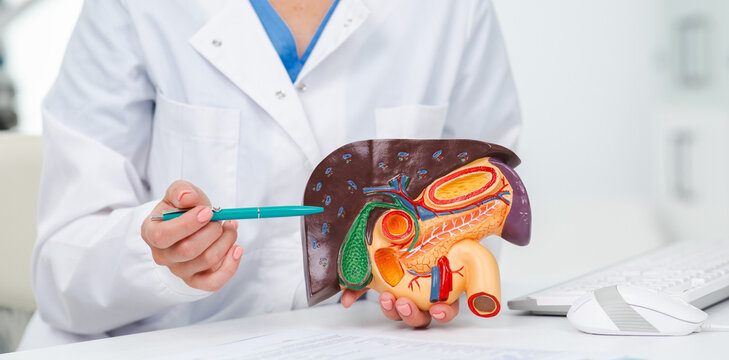 Human liver model on doctor's table, close-up. Treatment of hepatitis, cirrhosis and liver cancer