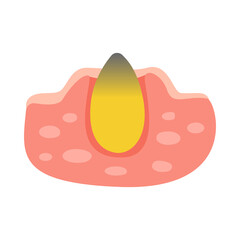 Acne facial type concept. vector illustration