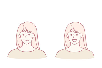 Skin problem and health concept. Stressed unhappy young woman with red acne pimples and smiling with healthy skin face vector illustration