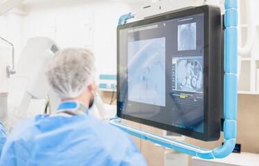 A medical technician, wearing surgical attire, intensely studies multiple complex x-ray scans on a large monitor during a medical procedure within a sterile operating room at the hospital