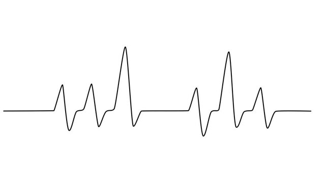 Heartbeat cardiogram continuous line art drawn animation. Heart pulse and rate symbol animated video, Animation of a single line drawing of a cardiogram. Continuous contour movement of a cardiogram. 