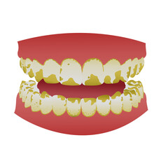 Illustrations showing teeth in an unhealthy state and teeth in a healthy state