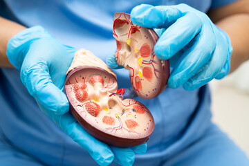 Chronic kidney disease, doctor with model for treatment urinary system, urology, Estimated...