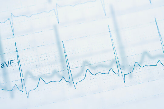 World Heart Rhythm Week concept. Electrocardiogram graph on paper. National Heart Health Month. World Heart Day awareness background.