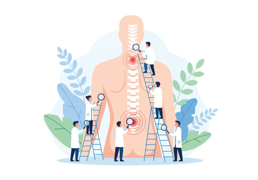 Flat style illustration of chiropractors examining spine with magnifying glasses and ladders, focusing on back pain treatment, posture correction, and medical healthcare for wellness and recovery - Powered by Adobe