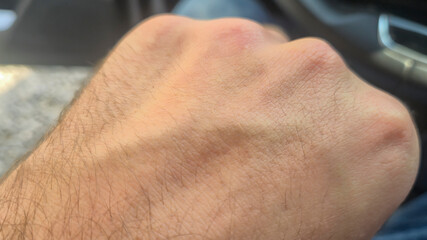 Close-up of a man's hand resting on a surface, featuring visible hair and skin texture. The hand is clenched, suggesting strength or determination, with a blurred background.