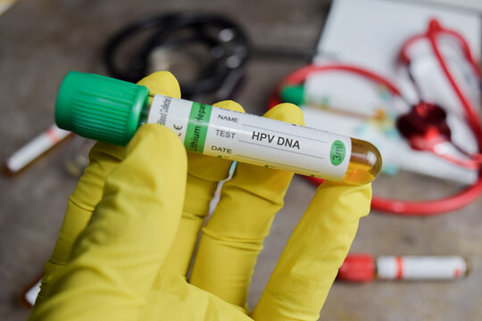 HPV DNA vaccination drug in green gloved hands. Medical concept