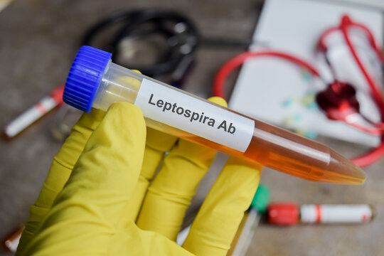 Leptospira Ab vaccination drug in green gloved hands. Medical concept