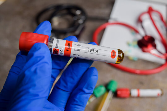 TPHA vaccination drug in blue gloved hands. Medical concept