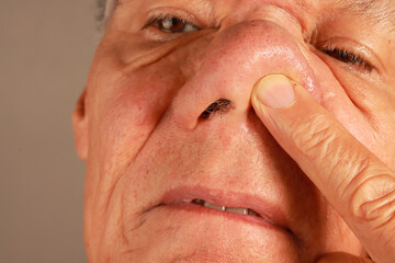 Man examine his wild nose hairs so he can pluck or trim them out