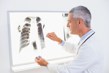 Chest X-ray film glowing on light board in clinical review area, with stethoscope hanging