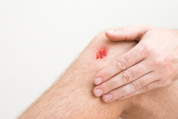 Young adult man hand touching leg with red abrasion bleeding knee skin after fell down. Isolated on...