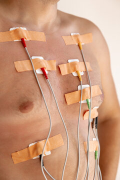 Man with medical electrodes on his chest for cardiac monitoring