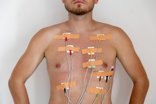 Man with medical electrodes on his chest for cardiac monitoring