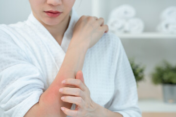 skin problem and beauty. Young woman scratch body has itchy skin from skin allergic, steroid allergy, sensitive skin, red from sunburn, chemical allergy, rash, insect bites, Seborrheic Dermatitis.