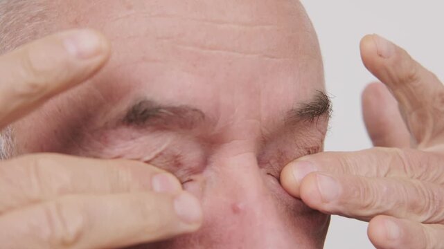 Close up mature senior man, fatigue syndrome eye Asthenopia, eye pain symptoms, including strain, allergies, blocked duct, severe eye conditions, corneal ulcers, glaucoma or acute angle-closure