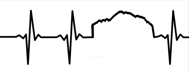 Fototapeta premium Electrocardiogram Waves - Civetta
