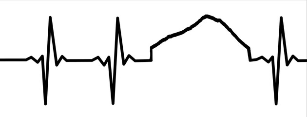 Fototapeta premium Electrocardiogram Waves - Everest