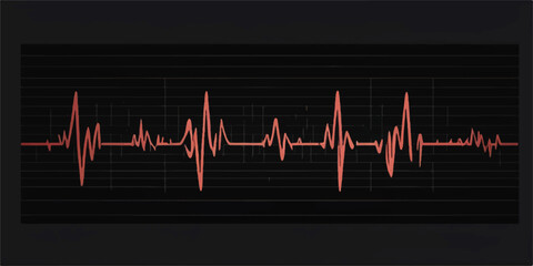 Obraz premium Heartbeat cardiogram on monitor and ECG illustration