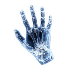 Naklejka premium X-ray image of a hand, showing bones