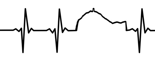 Fototapeta premium Electrocardiogram Waves of Pic du Midi profile, hiking heart rate, 2D conceptual graphic, black on white