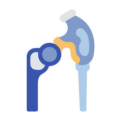 Simplified hip joint prosthesis illustration against black background
