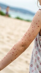 Childs Arm with Rash at Beach