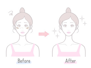 シミや肝斑など肌のビフォーアフター比較で伝える女性スキンケア効果イラスト