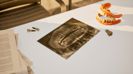 Dental clinic table scene with x-ray, dentures and implants in 3D rendering
