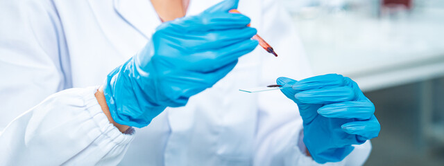 Close-up of a scientist in protective gloves placing a drop of blood on a glass slide for...
