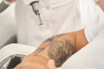 Asian female undergoing laser tattoo removal on arm by professional technician in clinic setting.