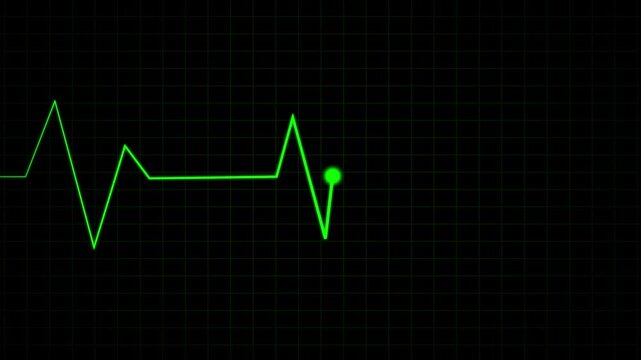 ECG cardiogram oscilloscope monitor. Pulse line shows heart rate on black background.Heartbeat lines animation background.