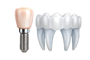 Dental implant and teeth isolated on a transparent background