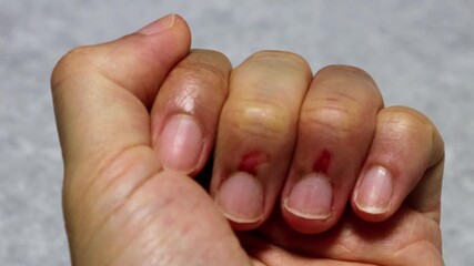 怪我をした指の動画