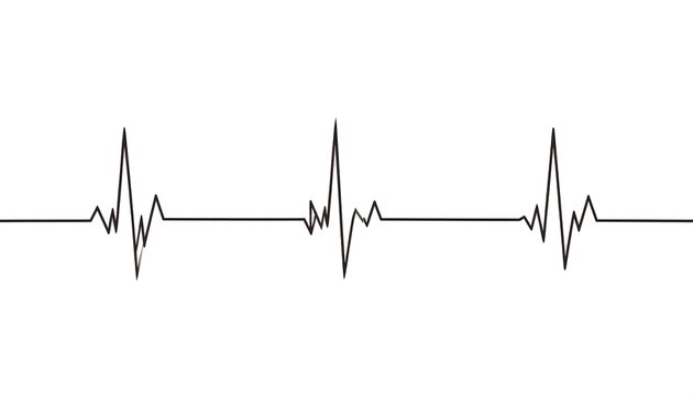 Heart rate monitor display